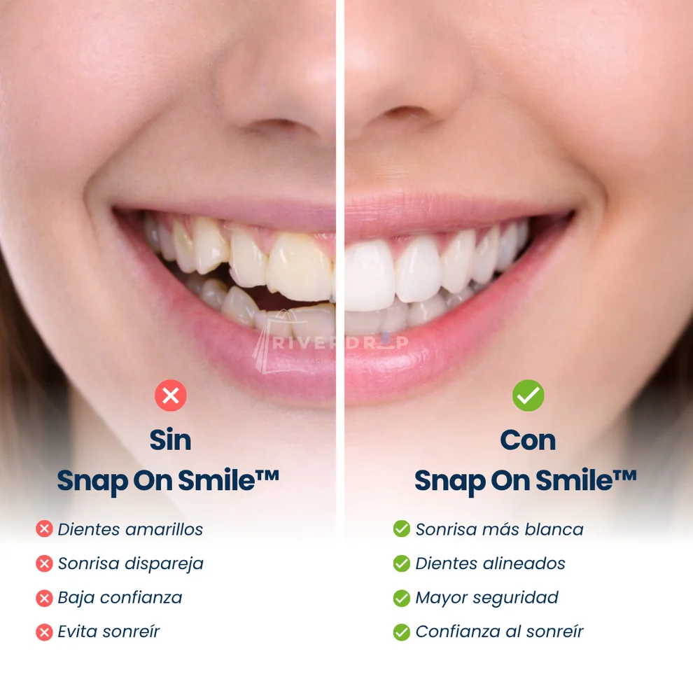 Snap On Smile™ - Confianza instantánea en tu sonrisa