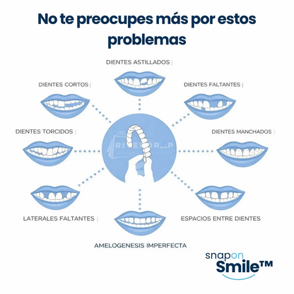 Snap On Smile™ - Confianza instantánea en tu sonrisa