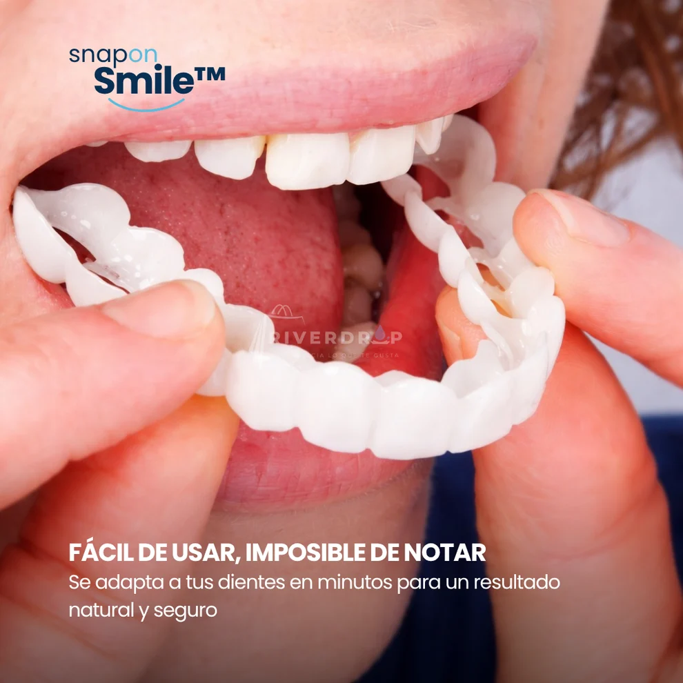 Snap On Smile™ - Confianza instantánea en tu sonrisa